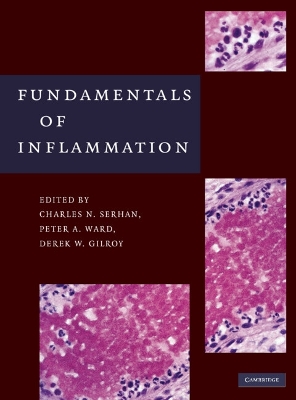 Fundamentals of Inflammation book