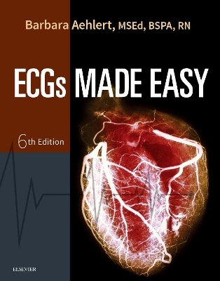 Ecgs Made Easy 6e book