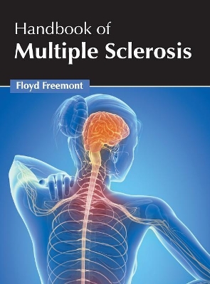 Handbook of Multiple Sclerosis book