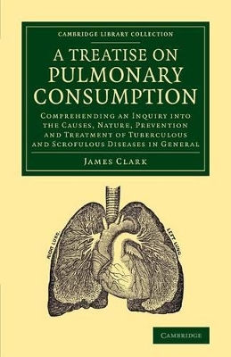 Treatise on Pulmonary Consumption book