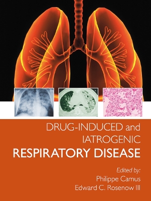 Drug-induced and Iatrogenic Respiratory Disease book