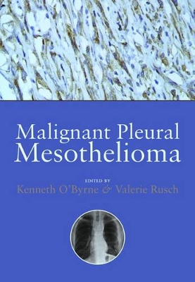 Malignant Pleural Mesothelioma book