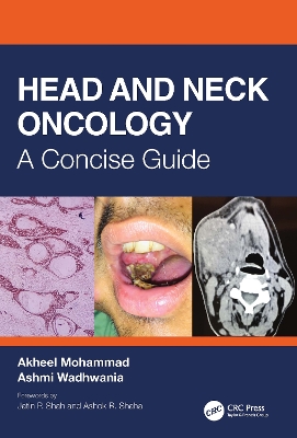 Head and Neck Oncology: A Concise Guide by Akheel Mohammad