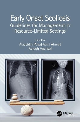 Early Onset Scoliosis: Guidelines for Management in Resource-Limited Settings book