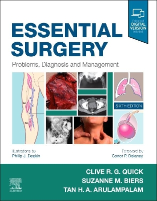 Essential Surgery: Problems, Diagnosis and Management by Philip J. Deakin