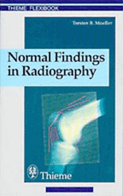 Normal Findings in Radiography book