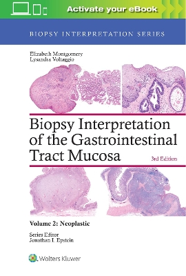 Biopsy Interpretation of the Gastrointestinal Tract Mucosa: Volume 2: Neoplastic by Elizabeth A. Montgomery