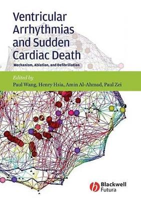 Ventricular Arrhythmias and Sudden Cardiac Death: Mechanism, Ablation, and Defibrillation by Paul J. Wang