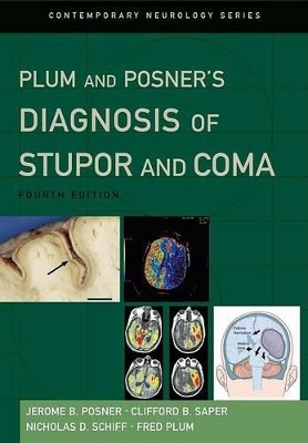 Plum and Posner's Diagnosis of Stupor and Coma book