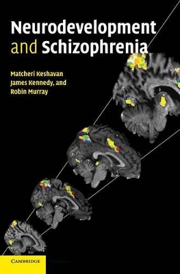 Neurodevelopment and Schizophrenia book