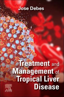 Treatment and Management of Tropical Liver Disease - E-Book book