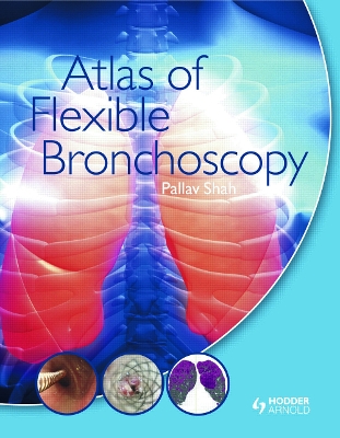 Atlas of Flexible Bronchoscopy by Pallav Shah