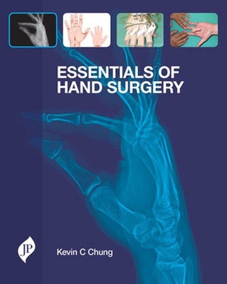 Essentials of Hand Surgery book