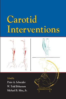 Carotid Interventions book