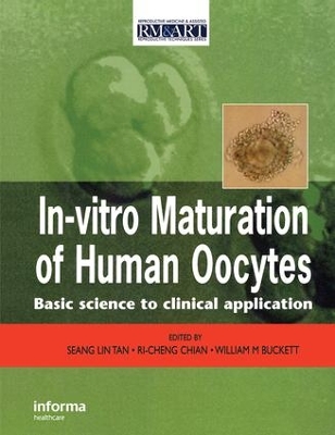 In-Vitro Maturation of Human Oocytes book