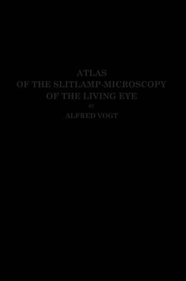 Atlas of the Slitlamp-Microscopy of the Living Eye book