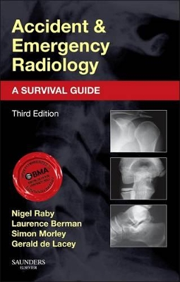 Accident and Emergency Radiology: A Survival Guide book