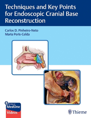 Techniques and Key Points for Endoscopic Cranial Base Reconstruction book