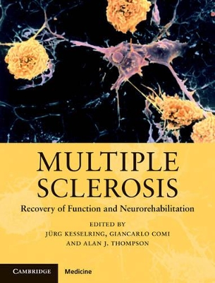 Multiple Sclerosis book