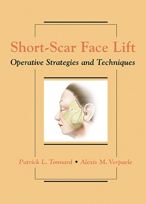 Short-Scar Face Lift book