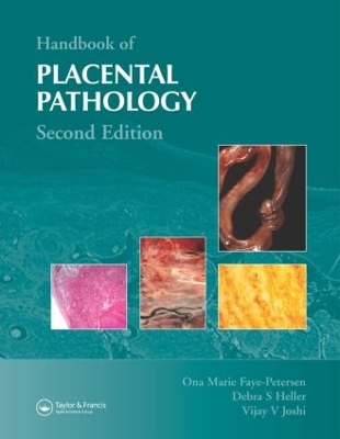 Handbook of Placental Pathology book