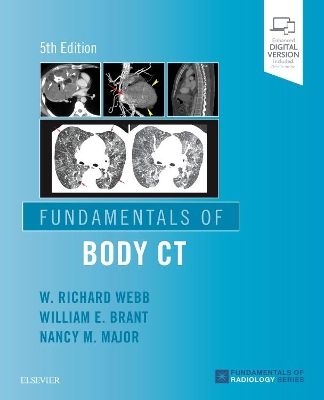 Fundamentals of Body CT book