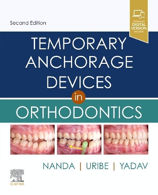 Temporary Anchorage Devices in Orthodontics by Ravindra Nanda