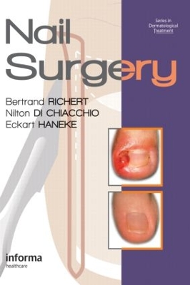 Nail Surgery book