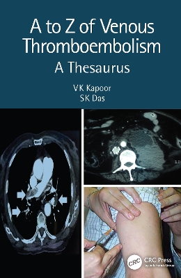 A to Z of Venous Thromboembolism: A Thesaurus book