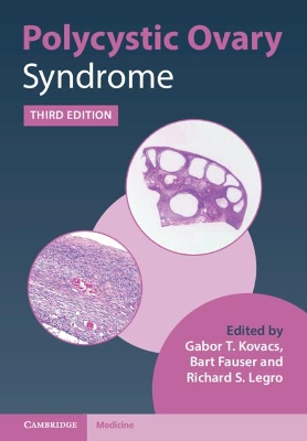 Polycystic Ovary Syndrome by Gabor T. Kovacs