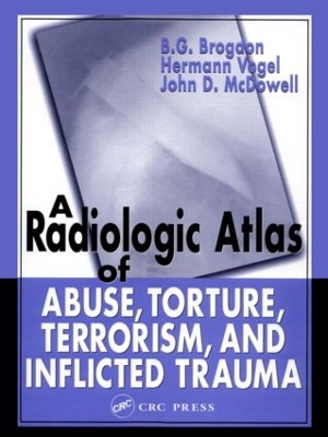 Radiologic Atlas of Abuse, Torture, Terrorism, and Inflicted Trauma book