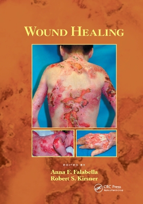 Wound Healing by Anna Falabella