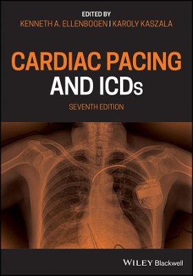 Cardiac Pacing and ICDs by Kenneth A. Ellenbogen