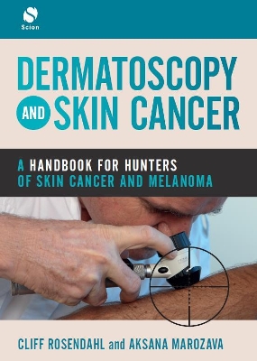 Dermatoscopy and Skin Cancer: A handbook for hunters of skin cancer and melanoma book