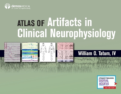 Atlas of Artifacts in Clinical Neurophysiology book