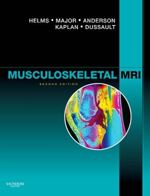 Musculoskeletal MRI book