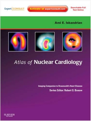Atlas of Nuclear Cardiology: Imaging Companion to Braunwald's Heart Disease book
