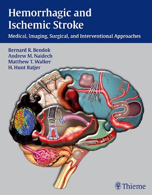 Hemorrhagic and Ischemic Stroke book