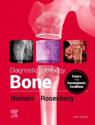 Diagnostic Pathology: Bone by G. Petur Nielsen