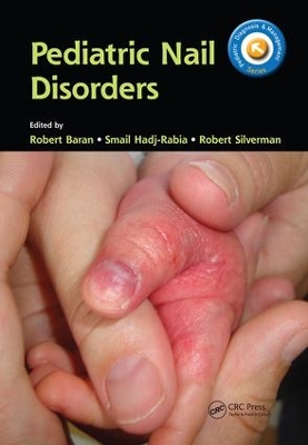 Pediatric Nail Disorders by Robert Baran