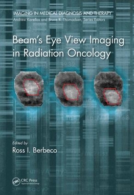 Beam's Eye View Imaging in Radiation Oncology book
