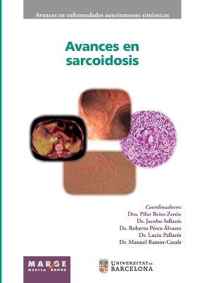 Avances en sarcoidosis book