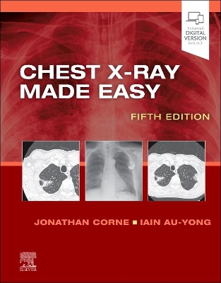 Chest X-Ray Made Easy by Jonathan Corne