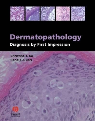 Dermatopathology: Diagnosis by First Impression book