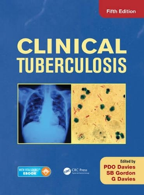 Clinical Tuberculosis by Peter D. O. Davies