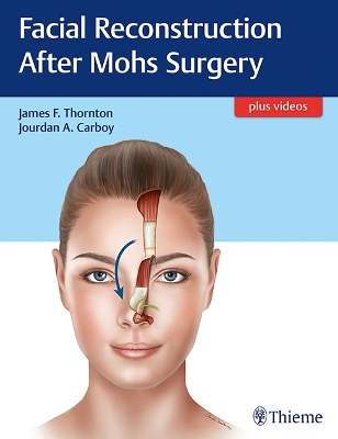 Facial Reconstruction After Mohs Surgery book