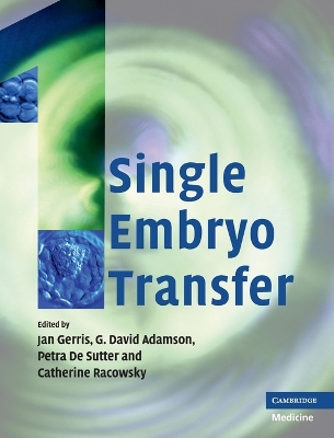 Single Embryo Transfer book