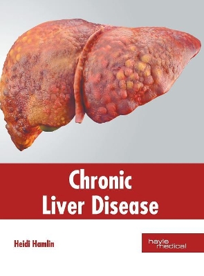 Chronic Liver Disease book