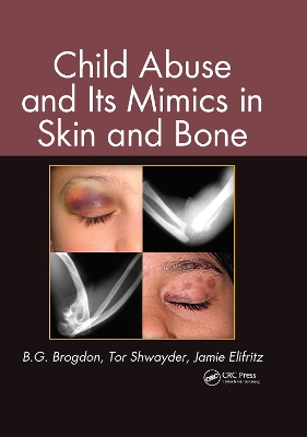 Child Abuse and its Mimics in Skin and Bone book