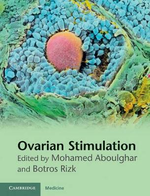 Ovarian Stimulation book